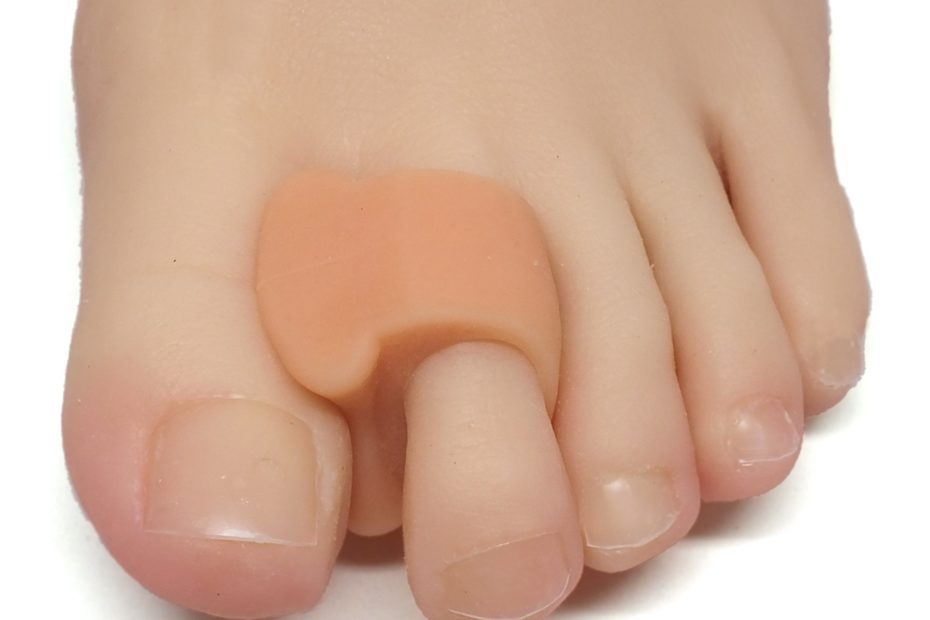 The Best Toe Separators That Can Offer Instant Relief