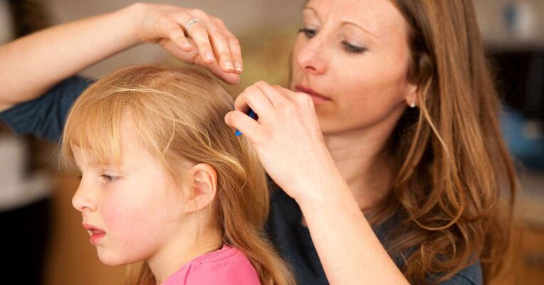 KP24 Lice Treatment